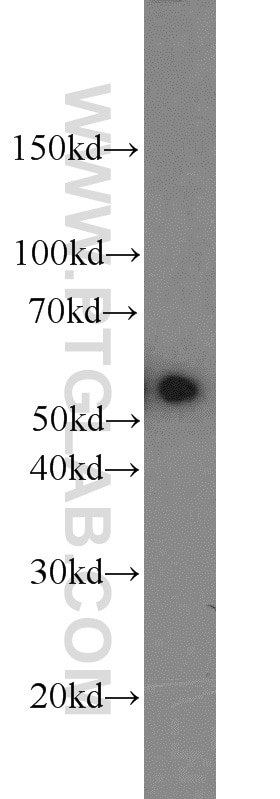 Western Blot (WB) analysis of mouse brain tissue using ACP2 Polyclonal antibody (15236-1-AP)