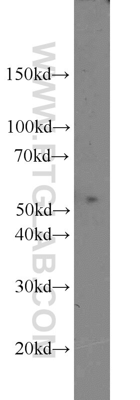 Western Blot (WB) analysis of mouse brain tissue using ACP2 Polyclonal antibody (15236-1-AP)