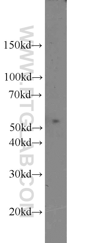 WB analysis of mouse brain using 15236-1-AP