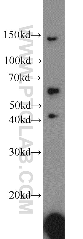 Western Blot (WB) analysis of HepG2 cells using ACP2 Polyclonal antibody (15236-1-AP)