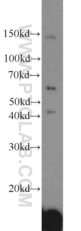 Western Blot (WB) analysis of HepG2 cells using ACP2 Polyclonal antibody (15236-1-AP)