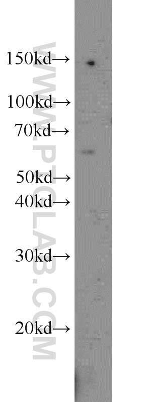 Western Blot (WB) analysis of HepG2 cells using ACP2 Polyclonal antibody (15236-1-AP)