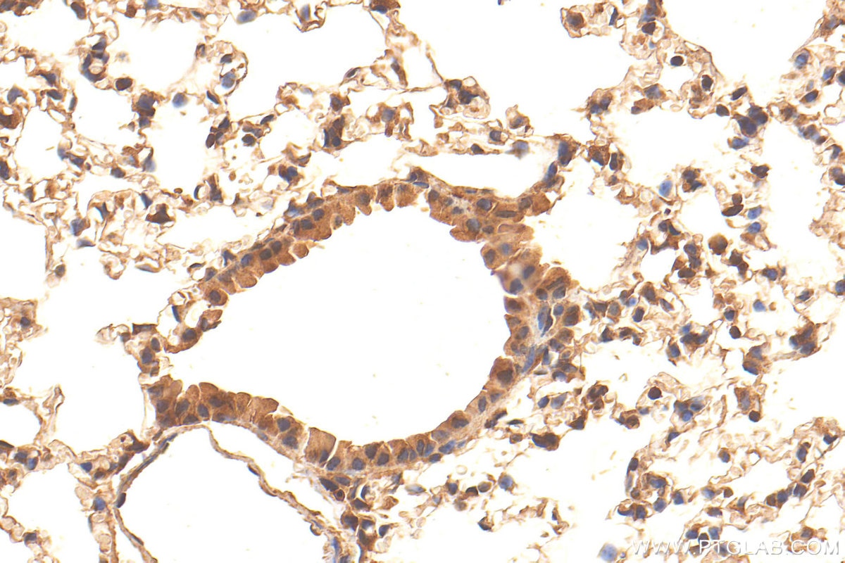 Immunohistochemistry (IHC) staining of mouse lung tissue using ACP5 Polyclonal antibody (11594-1-AP)
