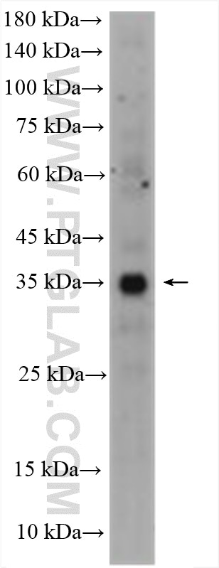 Western Blot (WB) analysis of various lysates using ACP5 Polyclonal antibody (11594-1-AP)