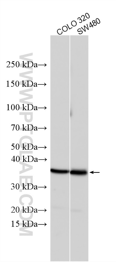 Western Blot (WB) analysis of various lysates using ACP5 Polyclonal antibody (11594-1-AP)
