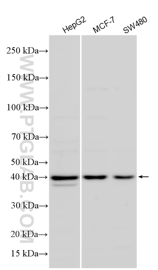 WB analysis using 27898-1-AP Western Blot (WB) analysis of various lysates using ACP5 Polyclonal antibody (27898-1-AP)