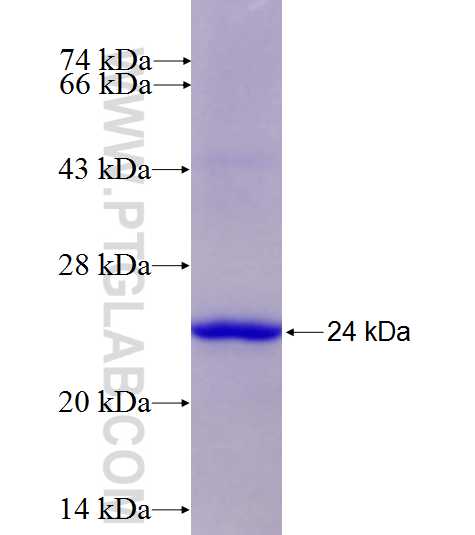 ACP5 fusion protein Ag27474 SDS-PAGE