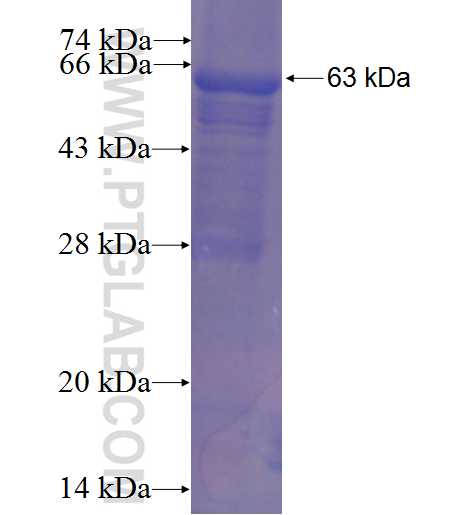 ACP5 fusion protein Ag2065 SDS-PAGE