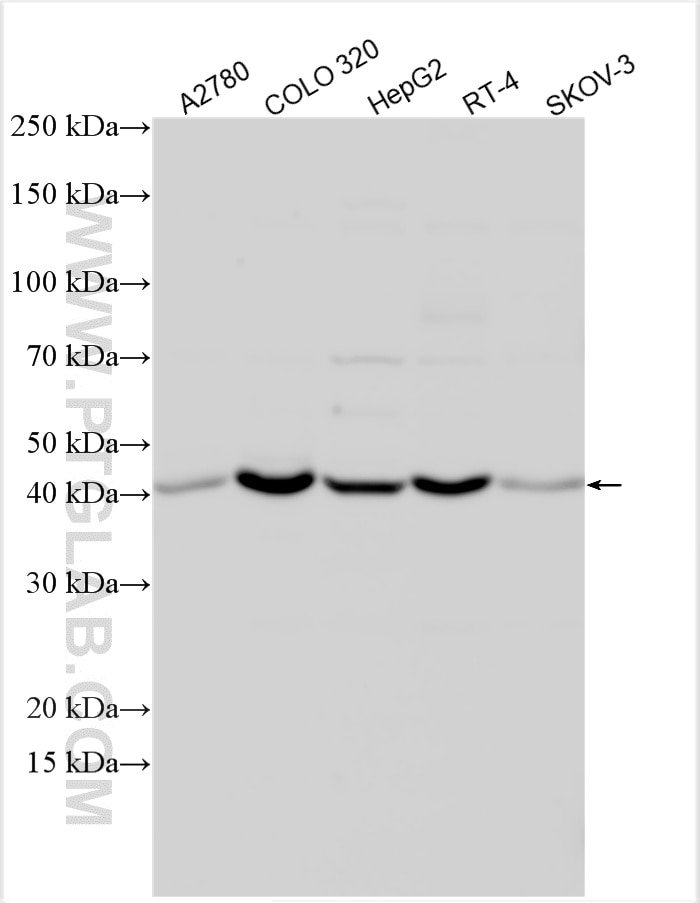 Western Blot (WB) analysis of various lysates using ACP6 Polyclonal antibody (12965-1-AP)