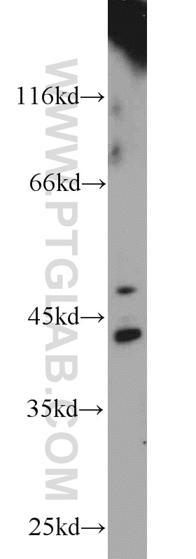 Western Blot (WB) analysis of mouse liver tissue using ACP6 Polyclonal antibody (12965-1-AP)