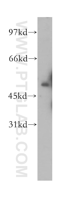 Western Blot (WB) analysis of human liver tissue using ACP6 Polyclonal antibody (12965-1-AP)