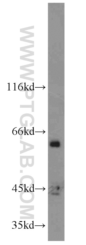 Western Blot (WB) analysis of COLO 320 cells using ACPP Polyclonal antibody (15840-1-AP)