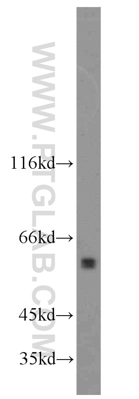 Western Blot (WB) analysis of mouse lung tissue using ACPP Polyclonal antibody (15840-1-AP)