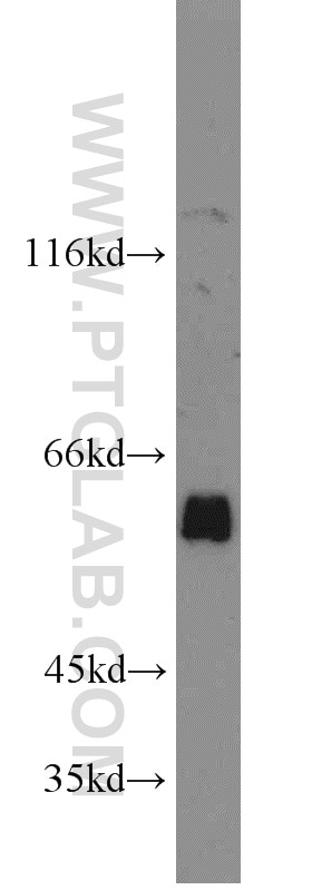 Western Blot (WB) analysis of PC-3 cells using ACPP Polyclonal antibody (15840-1-AP)