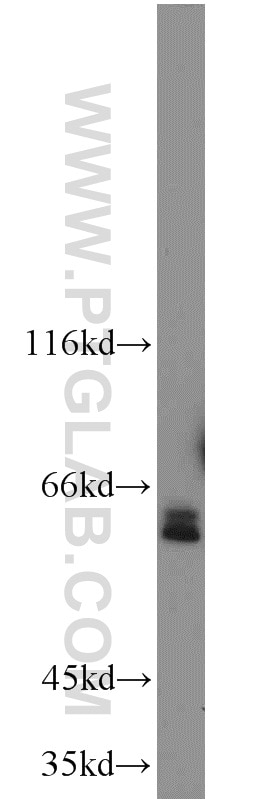 Western Blot (WB) analysis of mouse testis tissue using ACPP Polyclonal antibody (15840-1-AP)