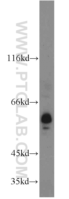 Western Blot (WB) analysis of MCF-7 cells using ACPP Polyclonal antibody (15840-1-AP)