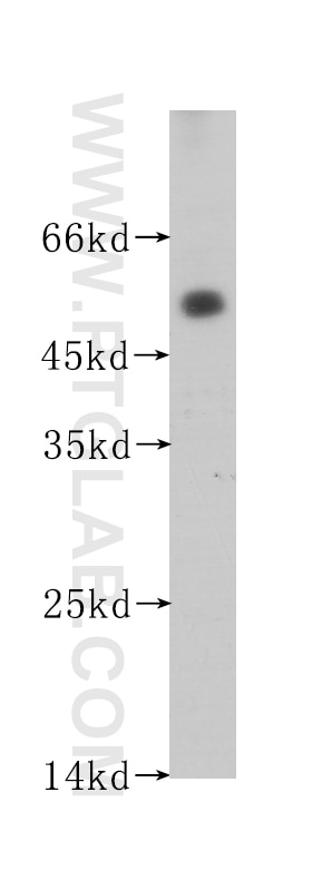 Western Blot (WB) analysis of human testis tissue using ACPP Monoclonal antibody (60176-1-Ig)