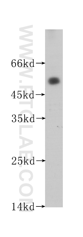 WB analysis of human testis using 60176-1-Ig