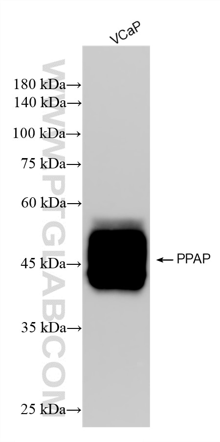 WB analysis using 87842-1-RR (same clone as 87842-1-PBS) Western Blot (WB) analysis of various lysates using ACPP Recombinant monoclonal antibody (87842-1-RR)