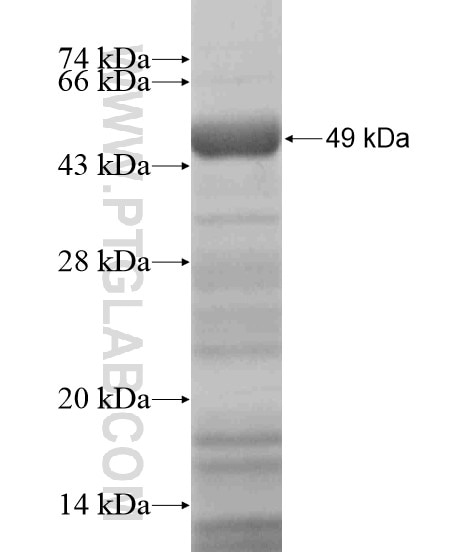 ACPP fusion protein Ag19701 SDS-PAGE