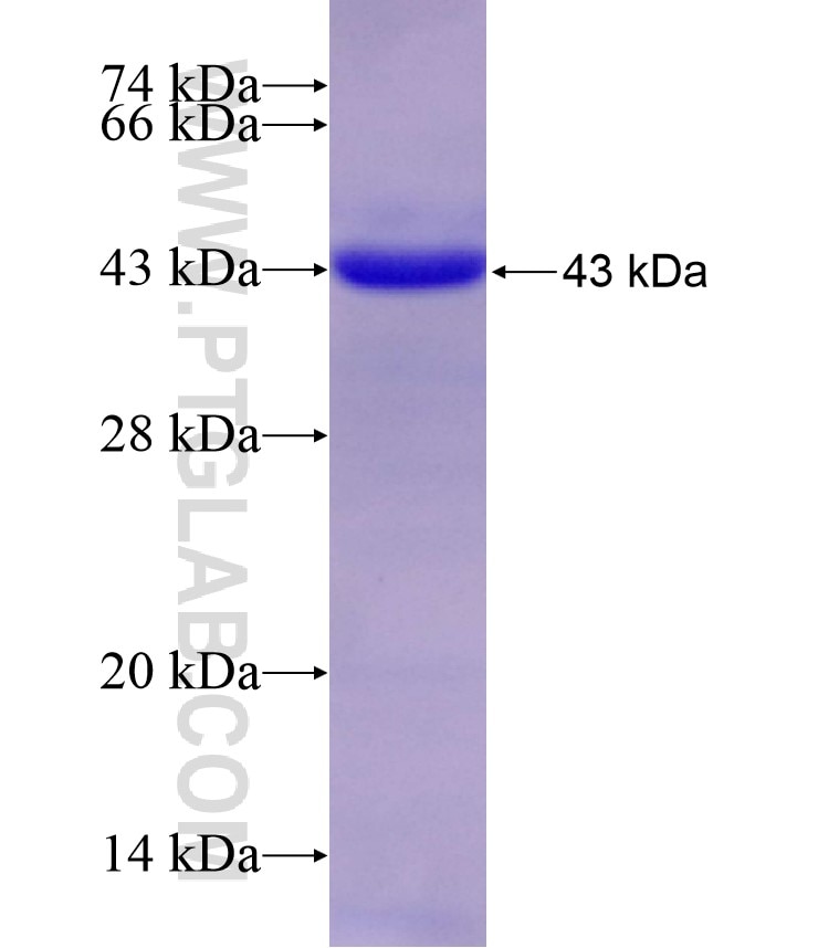 ACPP fusion protein Ag8578 SDS-PAGE