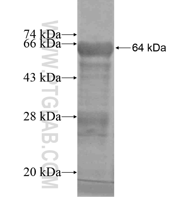ACPP fusion protein Ag8592 SDS-PAGE