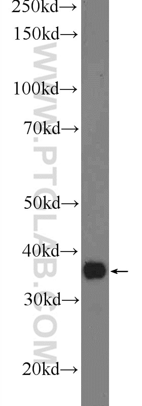 Western Blot (WB) analysis of mouse liver tissue using ACPT Polyclonal antibody (24326-1-AP)