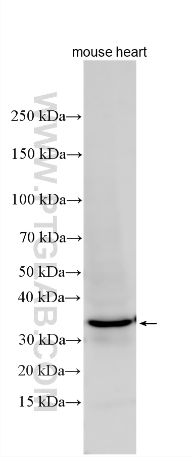 Western Blot (WB) analysis of various lysates using ACPT Polyclonal antibody (24326-1-AP)