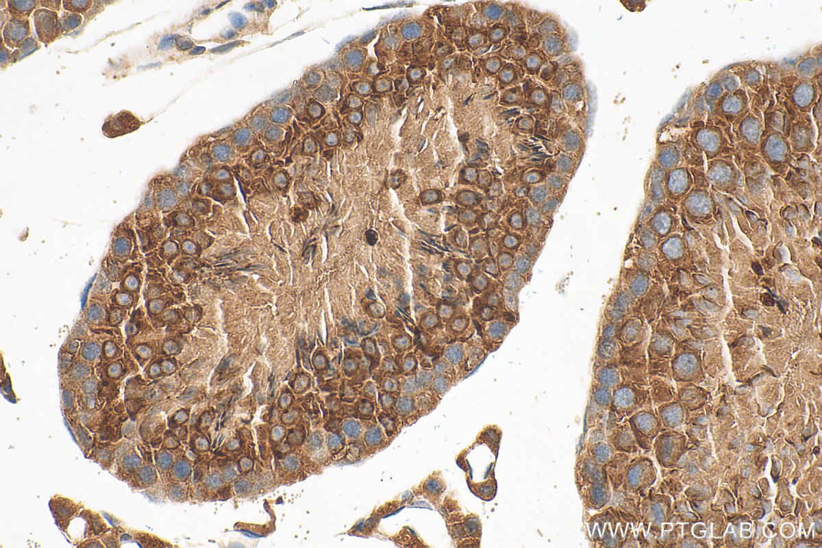 Immunohistochemistry (IHC) staining of mouse testis tissue using ACRBP Polyclonal antibody (12487-1-AP)