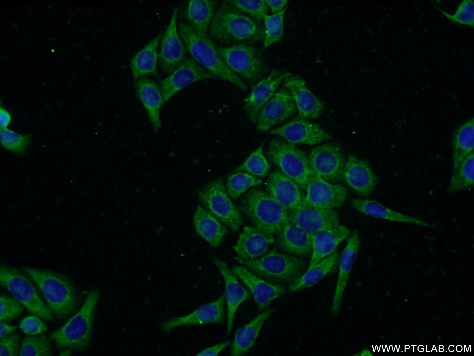 Immunofluorescence (IF) / fluorescent staining of PC-3 cells using ACRV1 Polyclonal antibody (14040-1-AP)