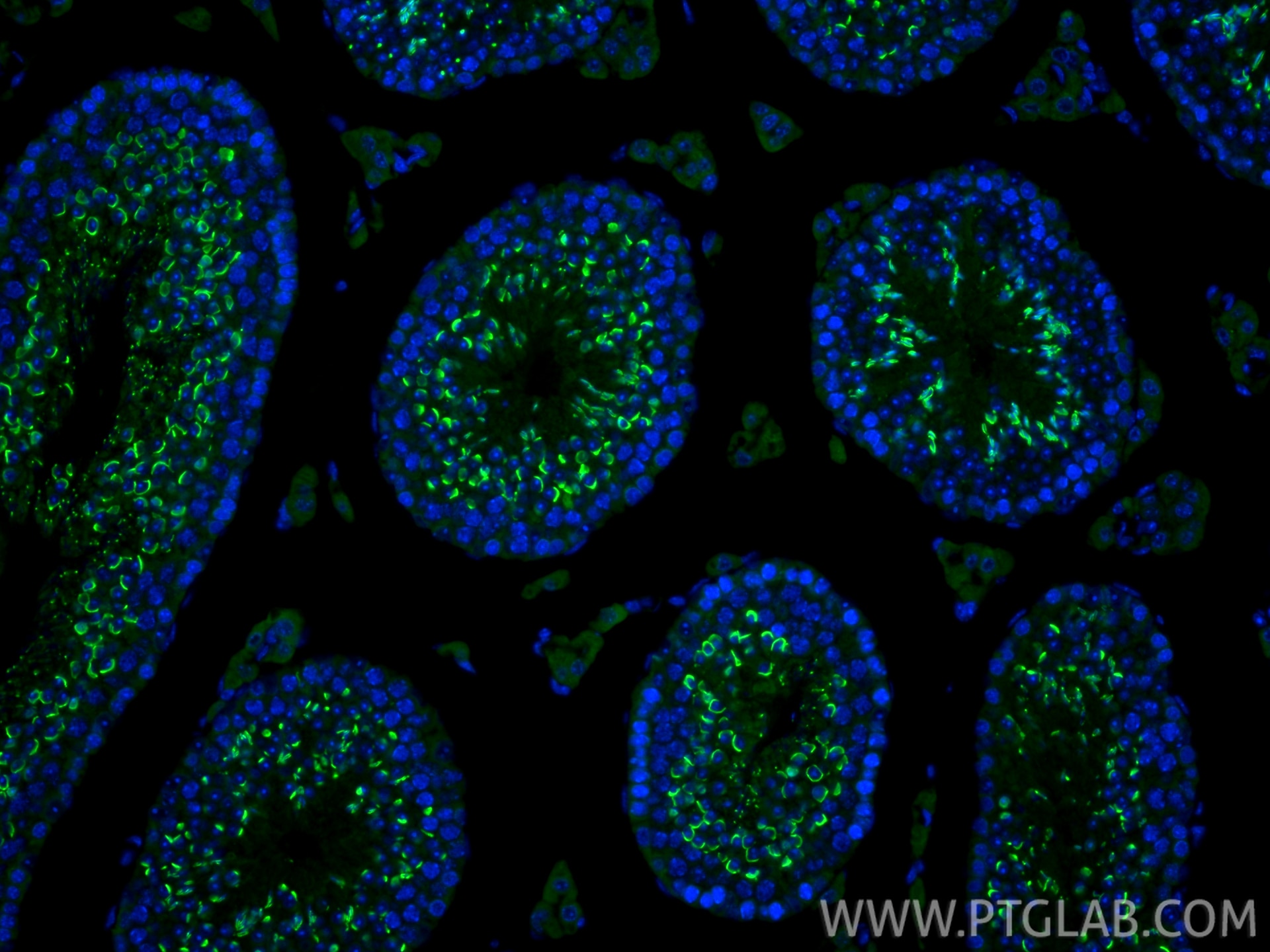 Immunofluorescence (IF) / fluorescent staining of mouse testis tissue using ACRV1 Polyclonal antibody (14040-1-AP)