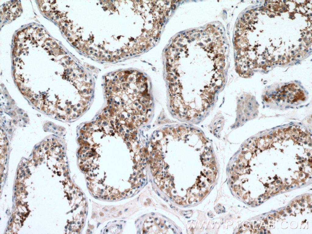 Immunohistochemistry (IHC) staining of human testis tissue using ACRV1 Polyclonal antibody (14040-1-AP)