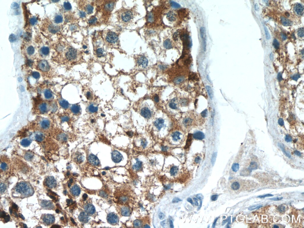 IHC staining of human testis using 14040-1-AP