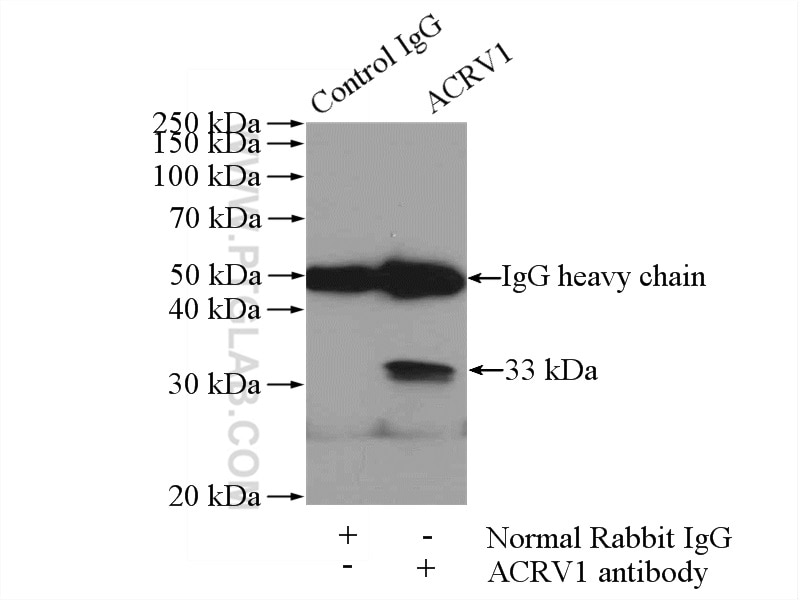 Immunoprecipitation (IP) experiment of DU 145 cells using ACRV1 Polyclonal antibody (14040-1-AP)