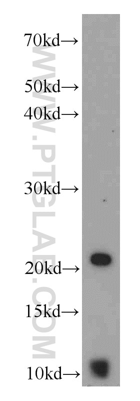 Western Blot (WB) analysis of LNCaP cells using ACRV1 Polyclonal antibody (14040-1-AP)