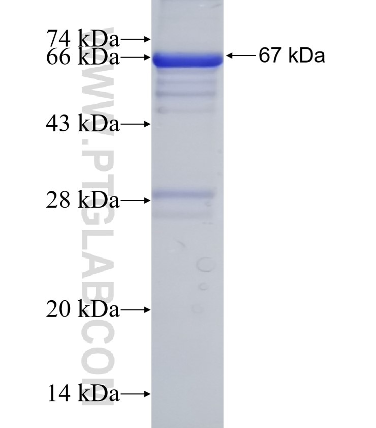ACRV1 fusion protein Ag5109 SDS-PAGE