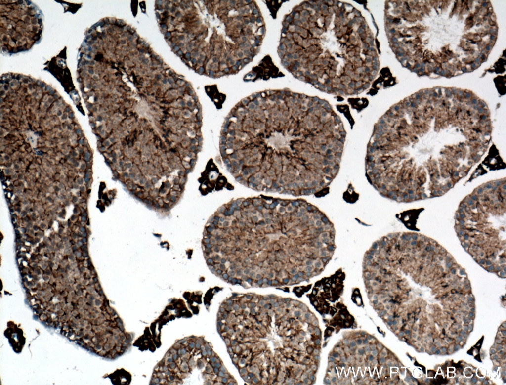 Immunohistochemistry (IHC) staining of mouse testis tissue using ACSBG1 Polyclonal antibody (16077-1-AP)