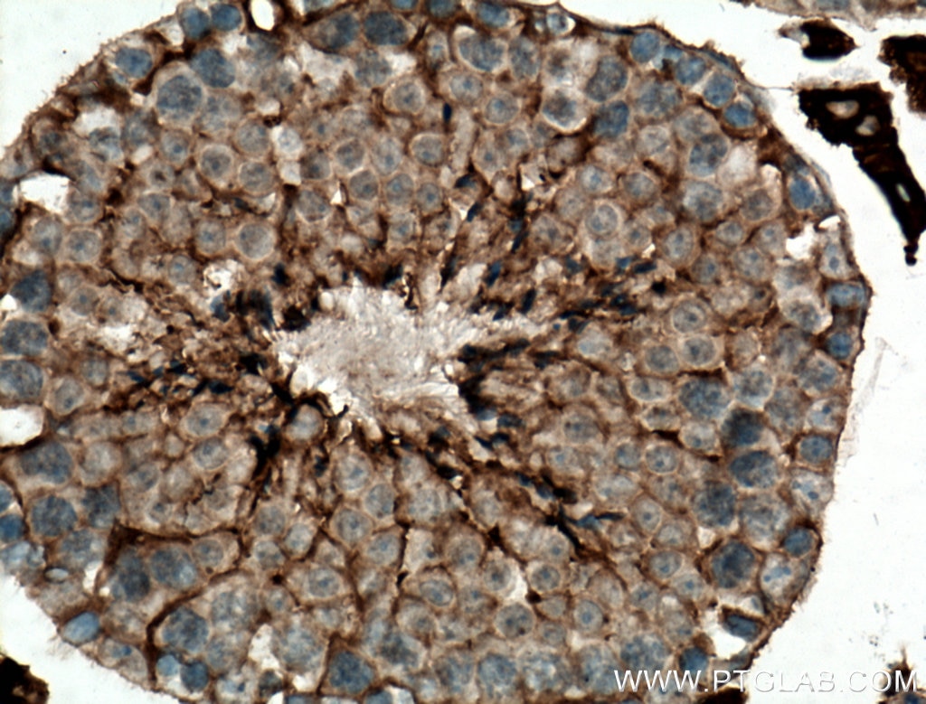 IHC staining of mouse testis using 16077-1-AP
