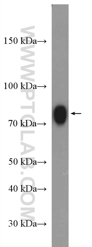 Western Blot (WB) analysis of rat testis tissue using ACSBG1 Polyclonal antibody (16077-1-AP)