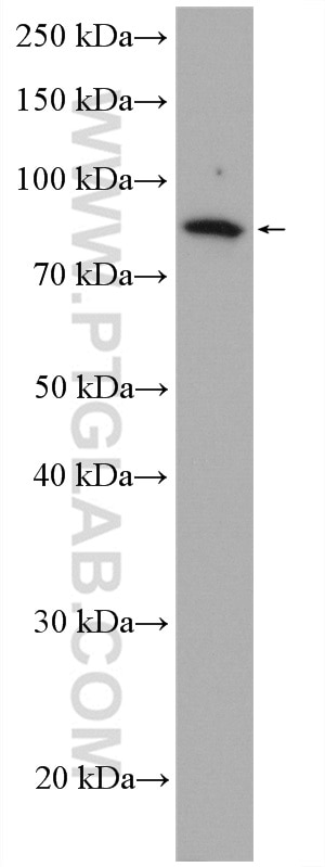 Western Blot (WB) analysis of mouse testis tissue using ACSBG1 Polyclonal antibody (16077-1-AP)