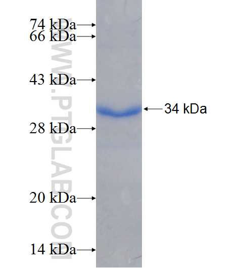 ACSBG1 fusion protein Ag25925 SDS-PAGE