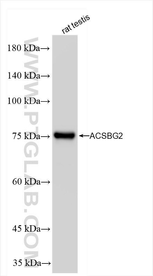 Western Blot (WB) analysis of rat testis tissue using ACSBG2 Recombinant antibody (85199-1-RR)
