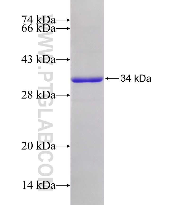 ACSBG2 fusion protein Ag5183 SDS-PAGE