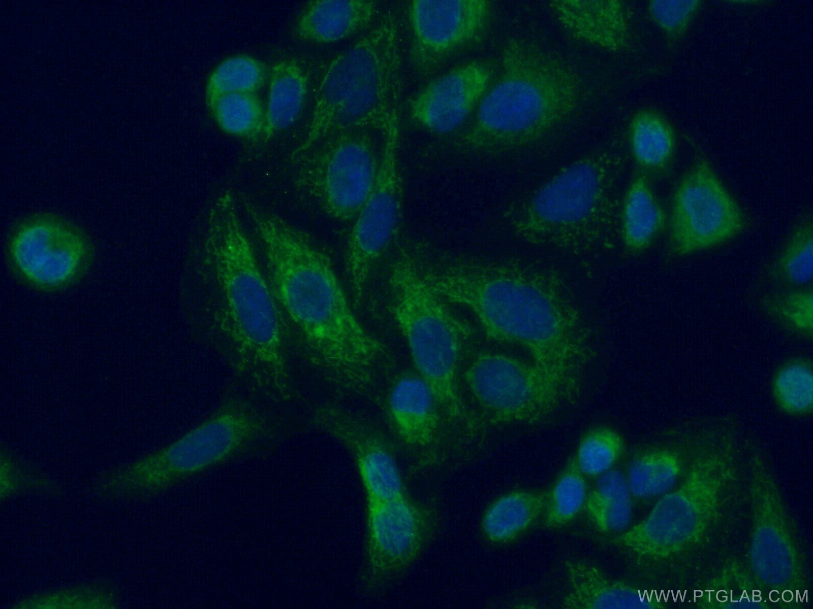 Immunofluorescence (IF) / fluorescent staining of A549 cells using ACSF2 Polyclonal antibody (16140-1-AP)