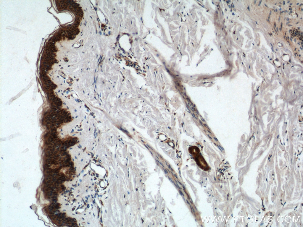 Immunohistochemistry (IHC) staining of human skin tissue using ACSF2 Polyclonal antibody (16140-1-AP)