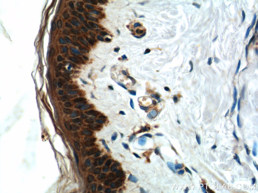 IHC staining of human skin using 16140-1-AP