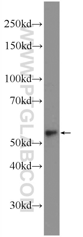 Western Blot (WB) analysis of mouse lung tissue using ACSF2 Polyclonal antibody (16140-1-AP)