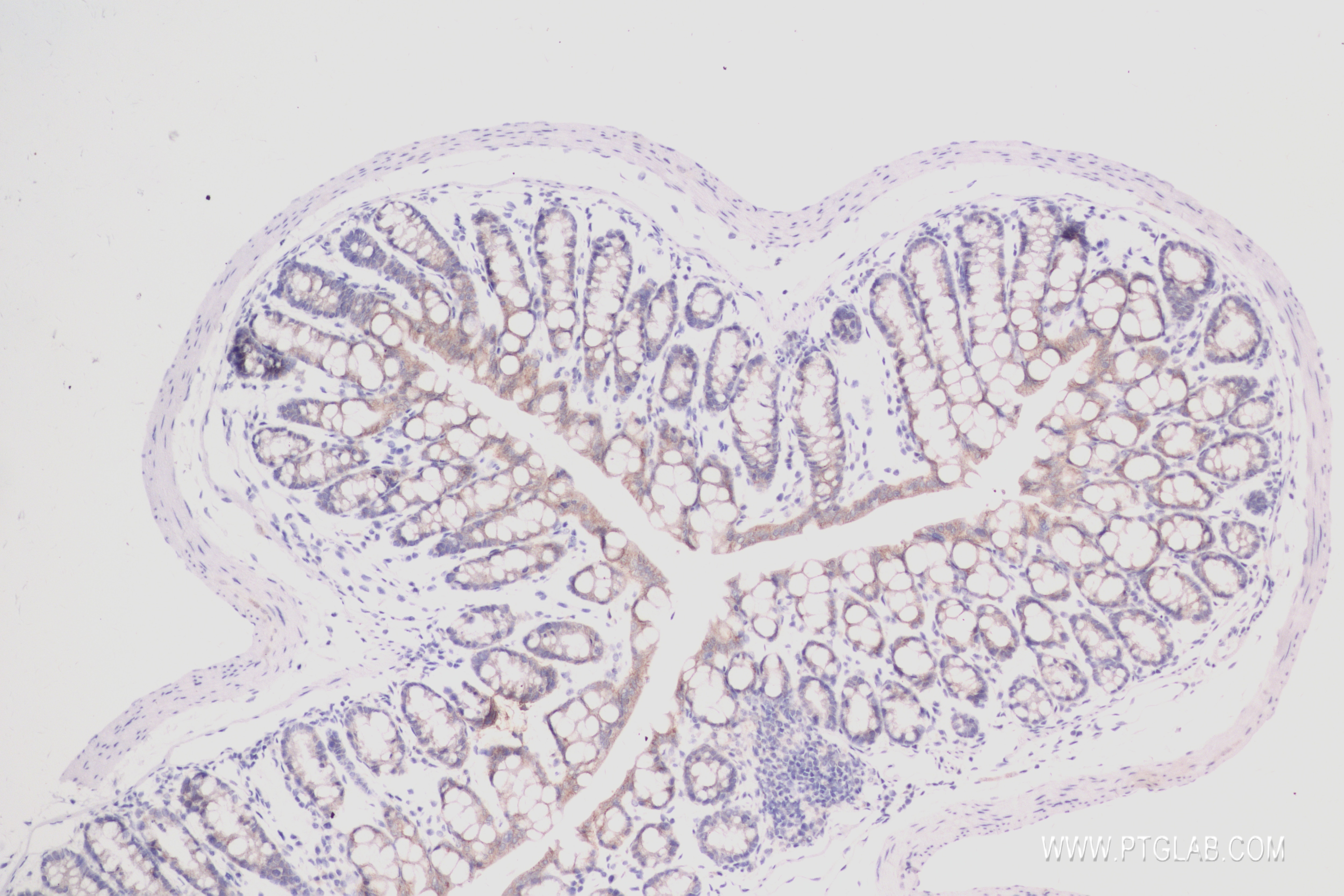 Immunohistochemistry (IHC) staining of mouse colon tissue using ACSF2 Recombinant antibody (84033-2-RR)