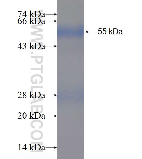 ACSF2 fusion protein Ag9199 SDS-PAGE
