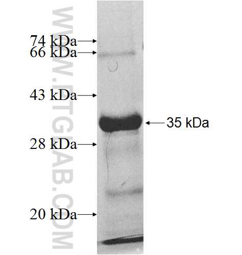 ACSF2 fusion protein Ag9309 SDS-PAGE